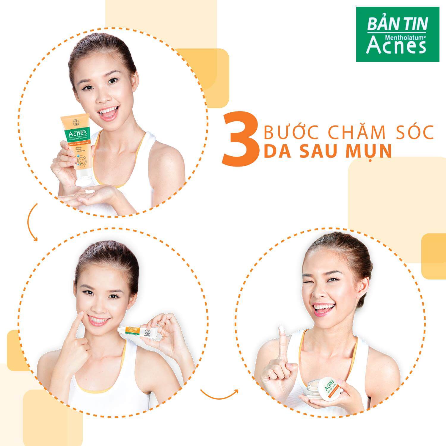Tìm hiểu kỹ cơ chế hình thành của sẹo và vết thâm sau mụn
